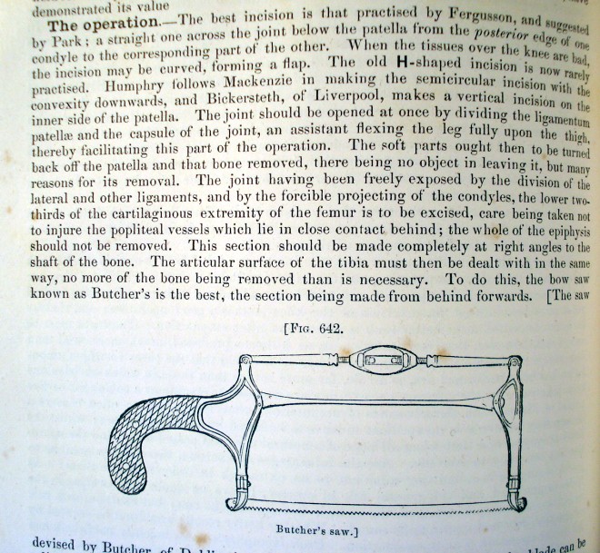 antique amputation engraving of butchers saw